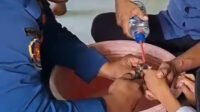 Proses evakuasi cincin yang tersangkut di jari korban.